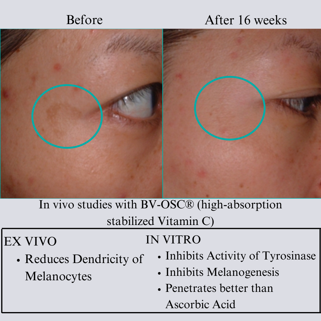 Nilceutica Hyaluron 3D Hydrator - Multi-Lamellar Emulsion