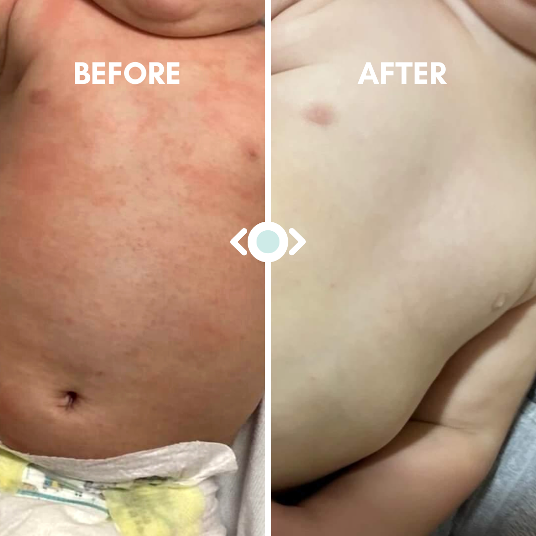 Baby Oatmeal Bath Treatment