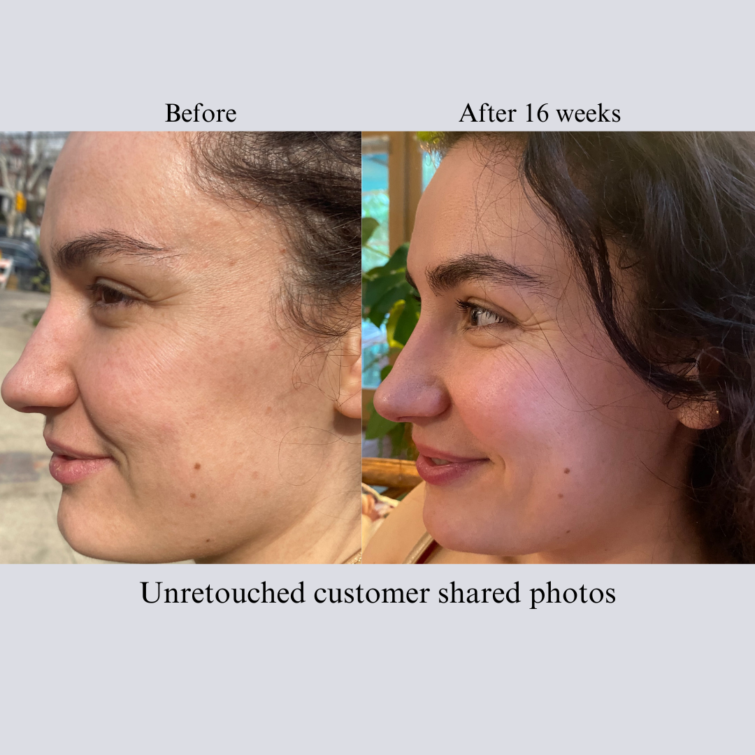 Nilceutica Anti-Aging Tight & Bright Serum - Advanced Gentle Phyto-Retinol and Vitamin C Face Serum